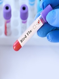 WHO confirms human bird flu case: Symptoms and prevention