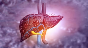 Global Fatty Liver Day | The rising threat of liver diseases — why screening matters